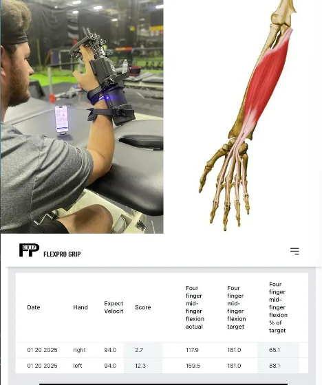 Baseball athlete completing FlexPro forearm capacity testing during elbow rehab