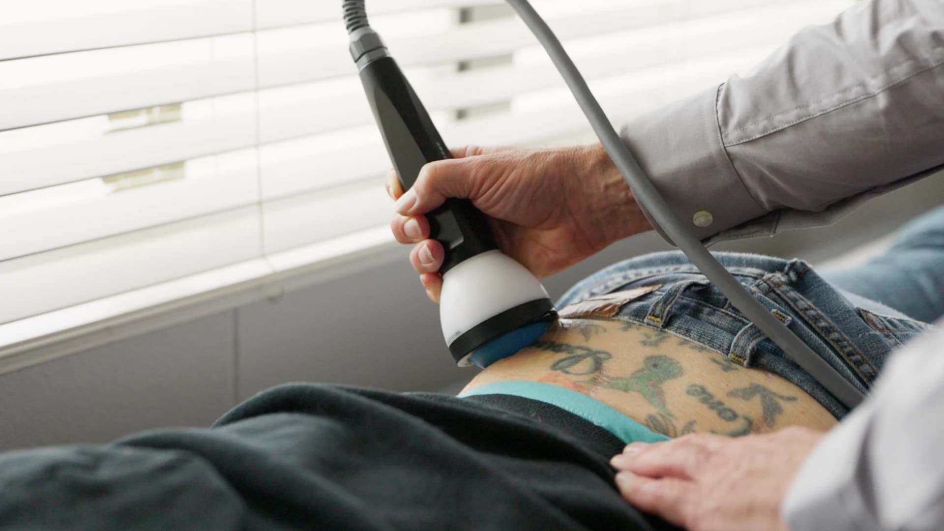 A focused shockwave treatment session for persistent pain